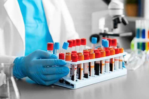 غربالگری رایگان دیابت و کلسترول در شهریار